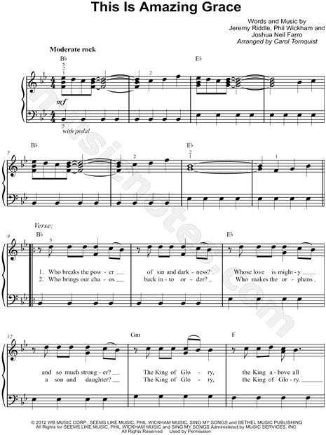 This Is Amazing Grace